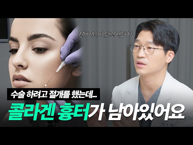 수술하다 알게 된 실리프팅 시술도 실력이 중요한 이유
