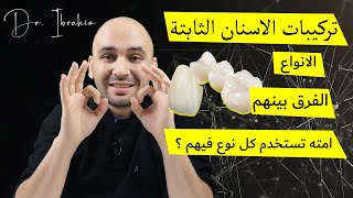 أنواع تركيبات الأسنان الثابتة | الفرق بين البورسلين والزيركون والايماكس | واستخداماتهم