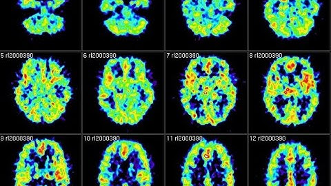 How does the brain generate consciousness?