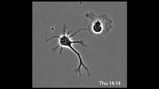 A normal neuron and a mutated neuron develop side by side Blog #7 Breaking Out of the Box