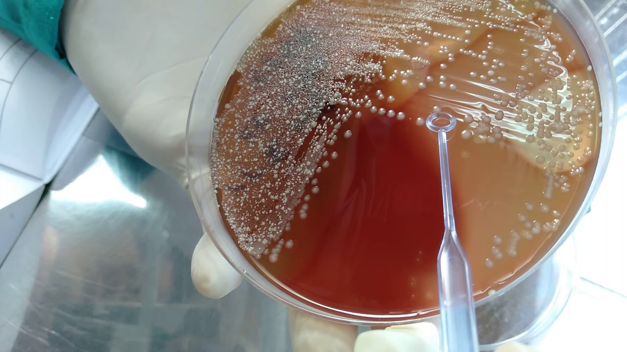 Moraxella catarrhalis on the blood agar and oxidase test YouTube