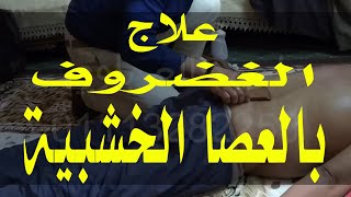 علاج الغضروف و آلام الظهر  بالعصا الخشبية والتدليك العلاجي و الفوطة النارية    احمد العرباوي