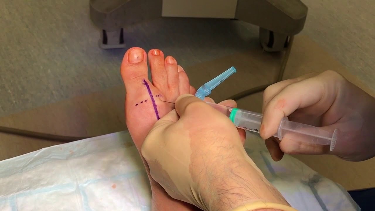 a vállízület helyreállítása artrózissal égő fájdalom a lábujjak ízületeiben