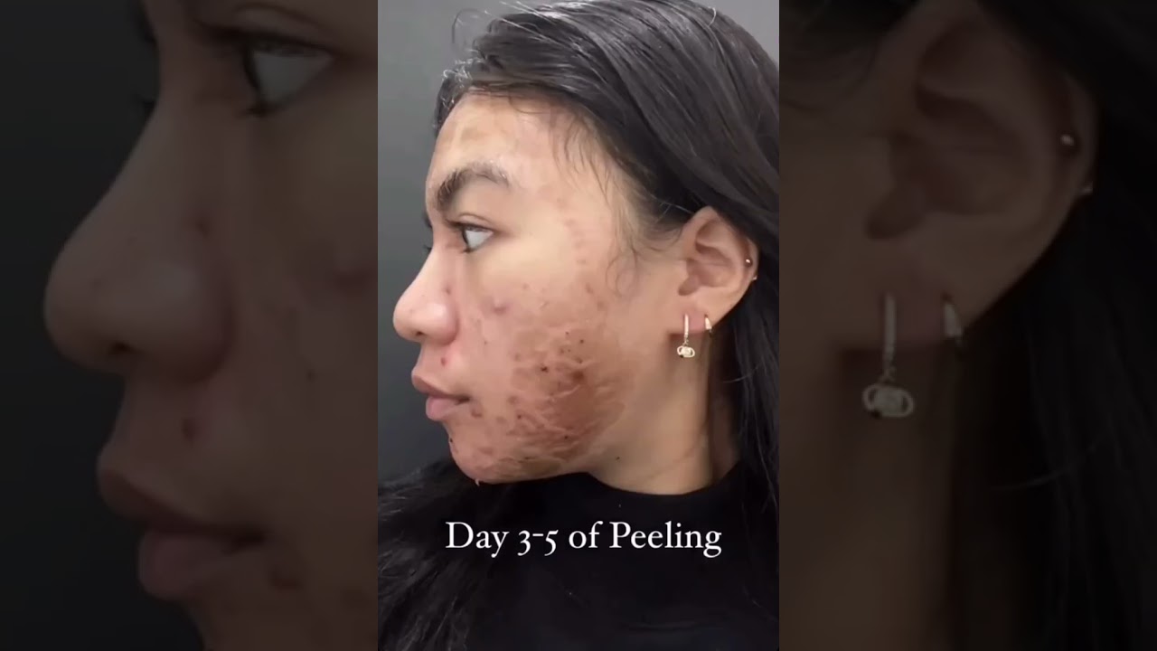 Zena Natural Algae Peeling 