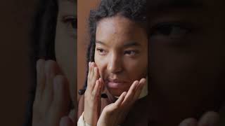ముఖంపై నల్ల మచ్చలు ఇలా చేస్తే మటుమాయం | Black Spots on Face, Skin & Body: Causes & Removal Tips