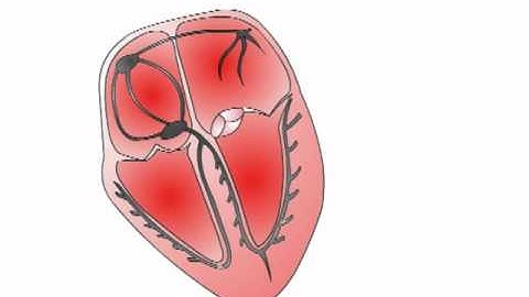 ECG Interpretation - The Cardiac Axis (Section 2, Part 3)