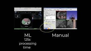 Machine Learning vs Manual with AR