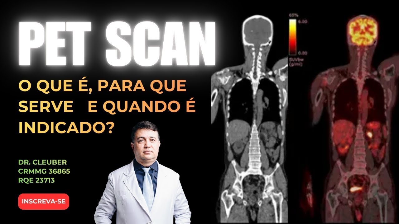 PET Scan: o exame que detecta o câncer antes dos sintomas aparecerem
