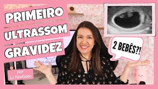 PRIMEIRO ULTRASSOM DA GRAVIDEZ Quando fazer o ultrassom transvaginal da gravidez?