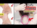 [8 Min] Fix NECK HUMP & BACK SHAPE | Fix neck hump in 30 day at home | bài tập giúp cố định gù cổ