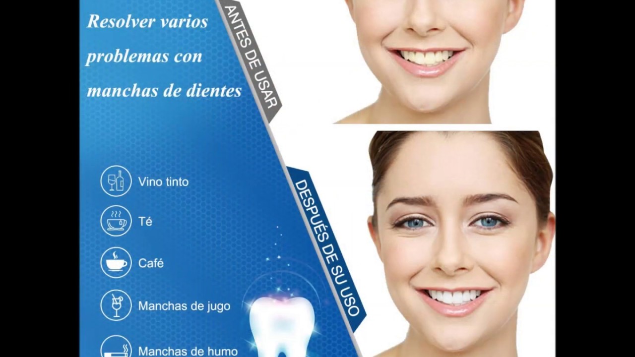 Cual es el mejor blanqueador dental