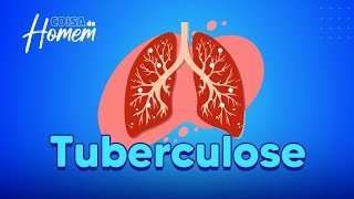 Saiba mais sobre a tuberculose | Coisa de Homem
