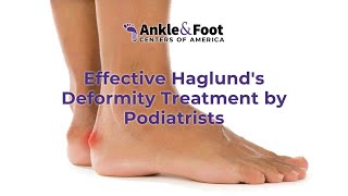 Effective Haglunds Deformity Treatment By Expert Podiatrists
