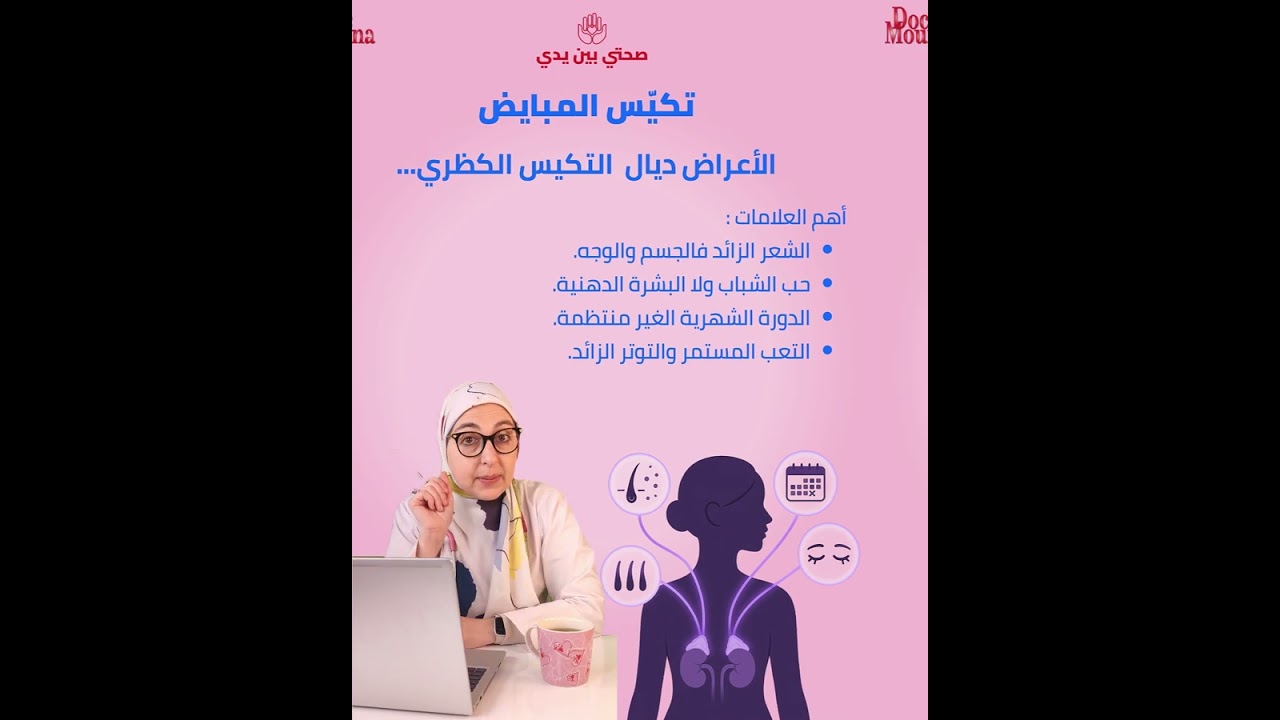 تكيس المبايض - أجي نتعرفو على تكيس المبايض الكضري