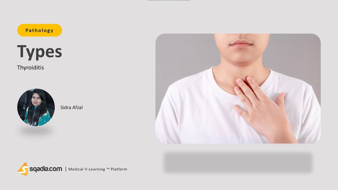 Thyroiditis | Types