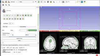 Assignment 3: Image Processing