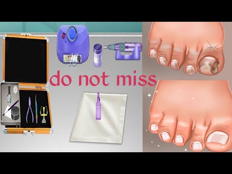 asmr toenail cleaning animation toenail cleaning animation asmr asmr ...