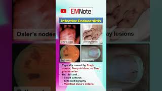 Infective Endocarditis doctor medical nursing