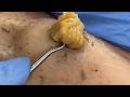 ๐บ๐๐๐๐๐๐๐๐๐ ๐ญ๐๐๐๐๐ ๐ช๐๐๐๐๐๐๐๐: ๐ด๐๐๐๐๐๐๐ ๐พ๐๐๐๐ ๐๐ ๐ช๐๐๐๐๐๐๐๐ ๐ถ๐๐ 3126