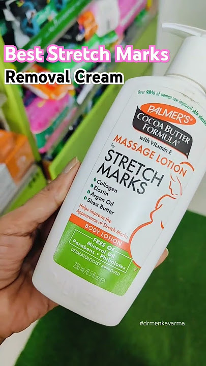 Post pregnancy Stretch Marks Cream 💫 palmers stretch mark cream | Remove Stretch Marks #drmenkavarma