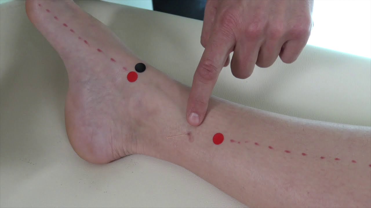 Cómo tratar el dolor en la inserción del elevador de la escápula.