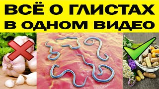 АНАЛИЗЫ  НЕ РАБОТАЮТ!   СИМПТОМЫ, ПРОФИЛАКТИКА, ЛЕЧЕНИЕ от глистов -  всё в одном видео !!!