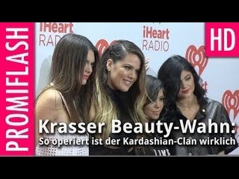 Video: Anahí Spricht über Schönheitsoperationen Und Kim Kardashian