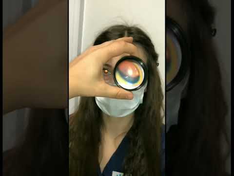 Увидеть сетчатку смартфоном #зрение #офтальмология #гаджет #shorts