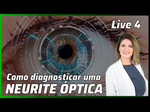 Live 4- Neurite óptica e como eu faço o diagnóstico na ressonância magnética