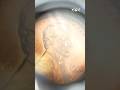 The Penny Is On Its Way Out But The Love For Them Endures For This Stayton Coin Collector 