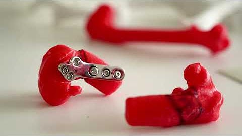 Veterinary student makes 3D models for surgeons