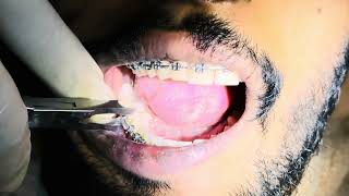 Dental Health
