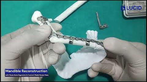 Mandibular Reconstruction using Fibula Free Flap | Step by Step Guide Mock Surgery Demo