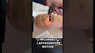 INCORRECT LARYNGOSCOPE MOTION #criticalcaremedicine #emergencymedicine#airwaymanagement #doctor