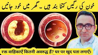 #1 Best AT HOME Test to Find Clogged Arteries!