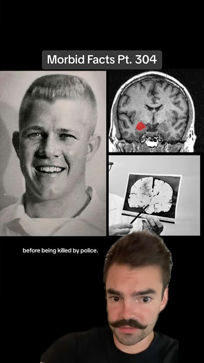 Was this massacre caused by a brain tumor?! #morbidfacts