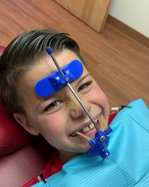 Underbite- gone! Class III orthopedics 👉🏼 3 months 𝐎𝐍𝐋𝐘!