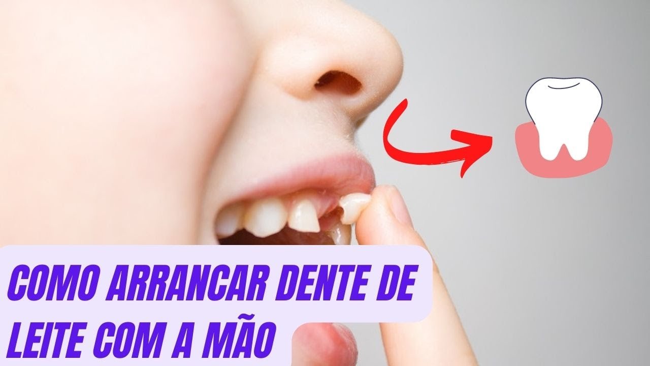 como arrancar dente de leite com a mão rápido e fácil, (confira) - YouTube
