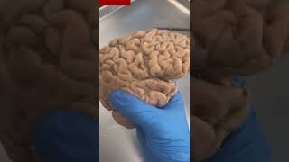 Human Brain and Frontal Cortex