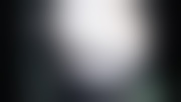 Fracture both the bones forearm, percutaneous elastic nailing radius, adamya hospital videos