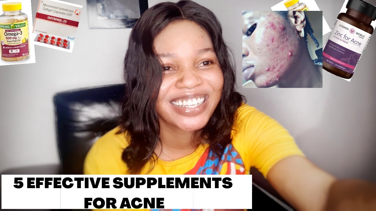 Five (5) MOST EFFECTIVE SKIN SUPPLEMENTS FOR ACNE/Cystic Acne/ zinc for