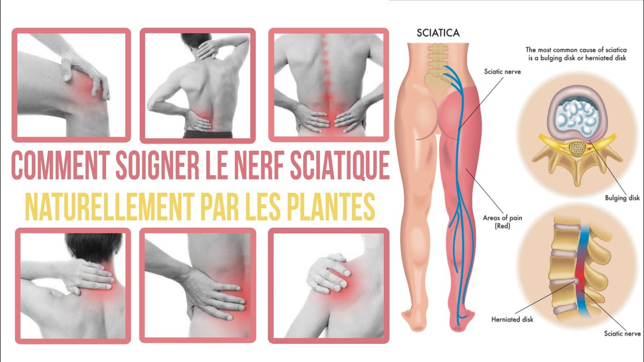 Comment soigner le nerf sciatique et douleurs naturellement PAR LES PLANTES☘️Serigne Mor Astou TOURÉ