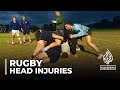 Rugby head injuries:  Hundreds of former players taking legal action