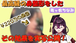 【毒ヶ衣ちなみ】￥220万かけて鼻をフル整形したちなみ先生 その効果を実写公開!! 【切り抜き】