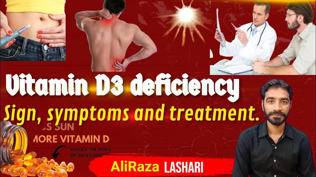 vitamin d deficiency symptoms urdu AliRaza Lashari YouTube
