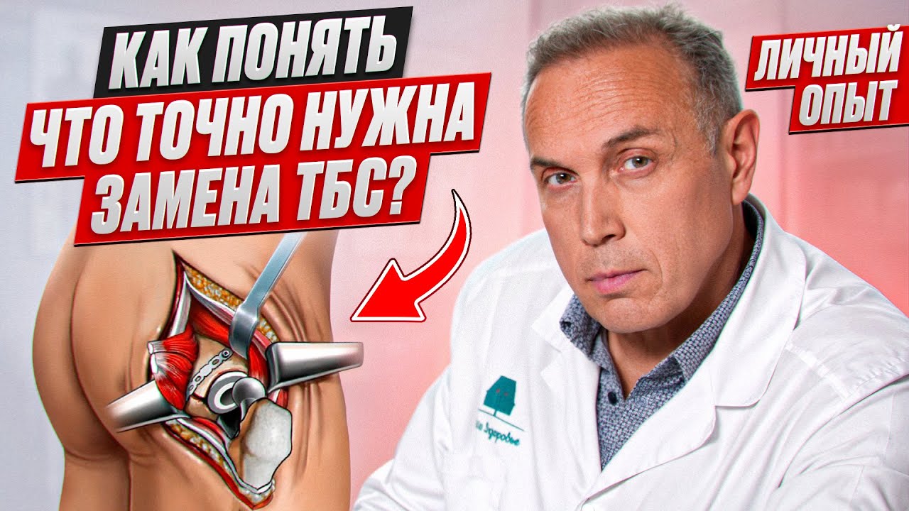 Не соглашайся НА ЭНДОПРОТЕЗИРОВАНИЕ до ЭТОГО ВОЗРАСТА – Когда соглашаться на замену сустава?