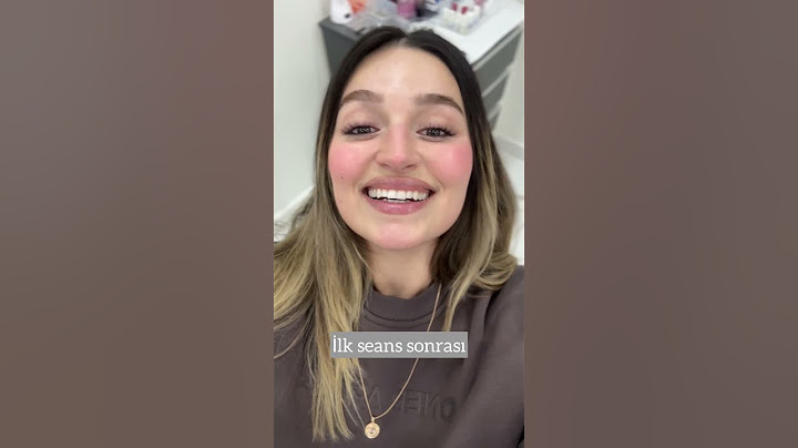 Dişlerimi Beyazlattırdım! | Diş Beyazlatma