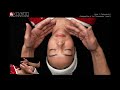 Technique 4: Combination of the Techniques 1 and 3