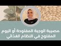 مصيبة الوجبة المفتوحة أو اليوم المفتوح في النظام الغذائي 