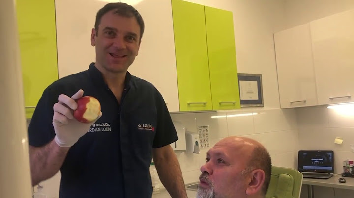 Jabuka posle ugradnje zubnih implantata - Test izdržljivosti